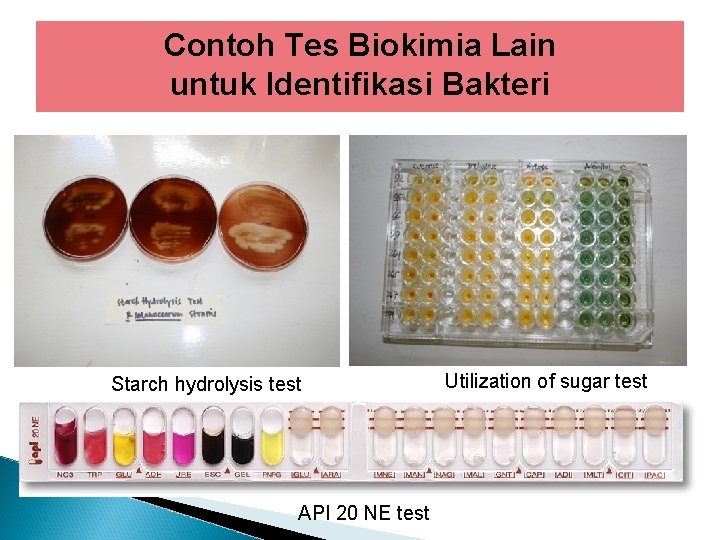 Contoh Tes Biokimia Lain untuk Identifikasi Bakteri Starch hydrolysis test API 20 NE test