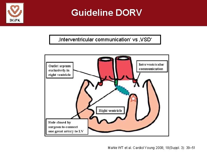 Guideline DORV ‚Interventricular communication‘ vs ‚VSD‘ Mahle WT et al. Cardiol Young 2008; 18(Suppl.
