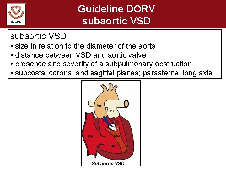 Guideline DORV subaortic VSD • size in relation to the diameter of the aorta