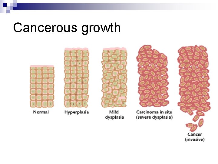 Cancerous growth 