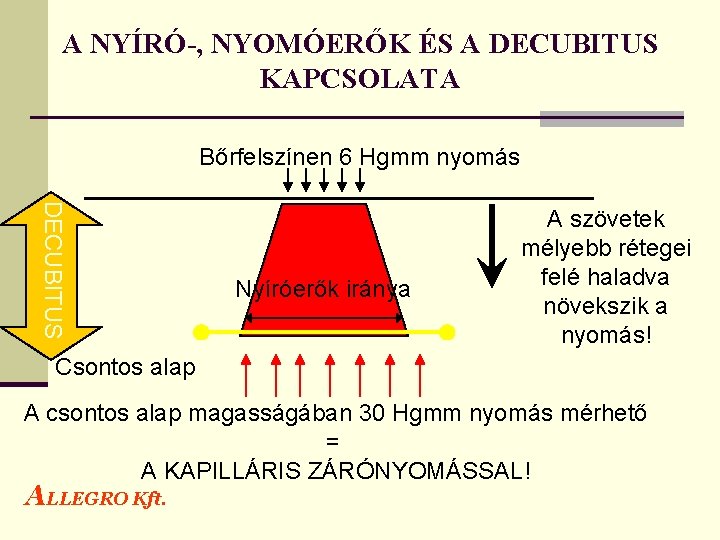 A NYÍRÓ-, NYOMÓERŐK ÉS A DECUBITUS KAPCSOLATA Bőrfelszínen 6 Hgmm nyomás DECUBITUS Nyíróerők iránya