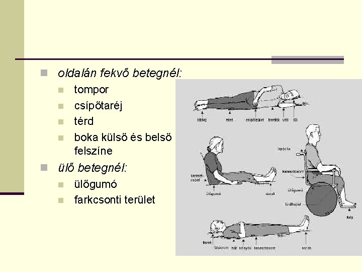 n oldalán fekvő betegnél: n tompor n csípőtaréj n térd n boka külső és