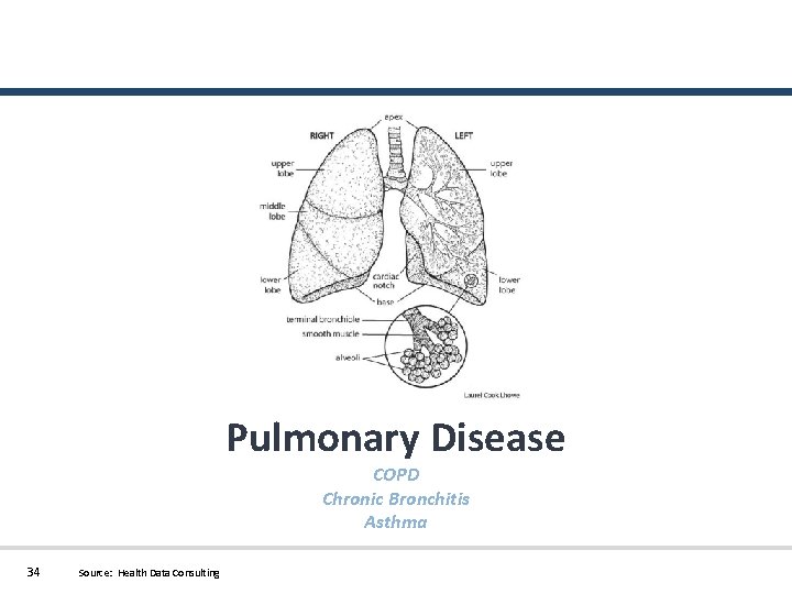 Pulmonary Disease COPD Chronic Bronchitis Asthma 34 Source: Health Data Consulting 