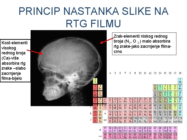 PRINCIP NASTANKA SLIKE NA RTG FILMU Kost-elementi visokog rednog broja (Ca)-više absorbira rtg zrake