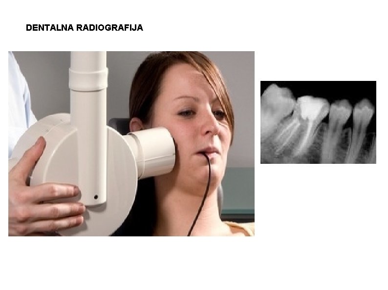 DENTALNA RADIOGRAFIJA 