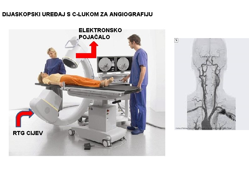 DIJASKOPSKI UREĐAJ S C-LUKOM ZA ANGIOGRAFIJU ELEKTRONSKO POJAČALO RTG CIJEV 