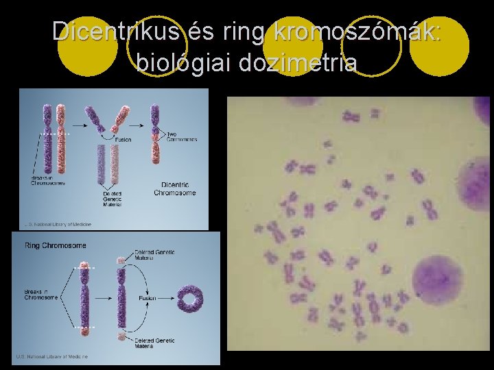 Dicentrikus és ring kromoszómák: biológiai dozimetria 