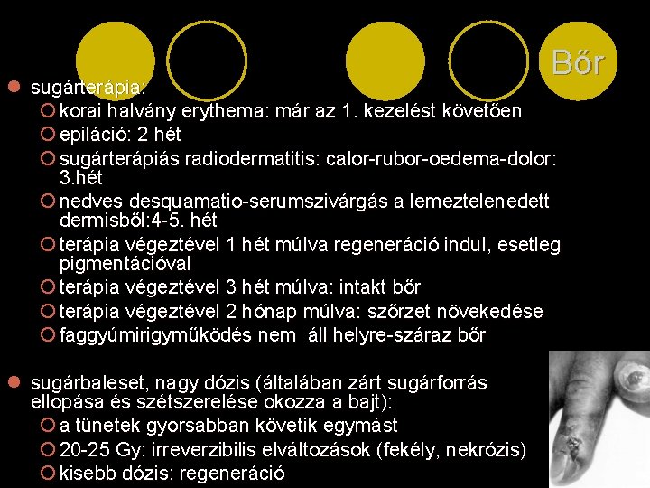 Bőr l sugárterápia: ¡ korai halvány erythema: már az 1. kezelést követően ¡ epiláció: