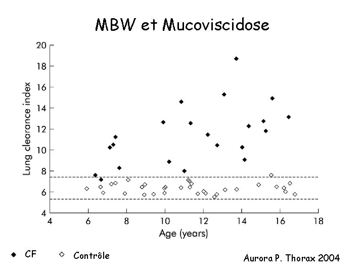 MBW et Mucoviscidose CF Contrôle Aurora P. Thorax 2004 