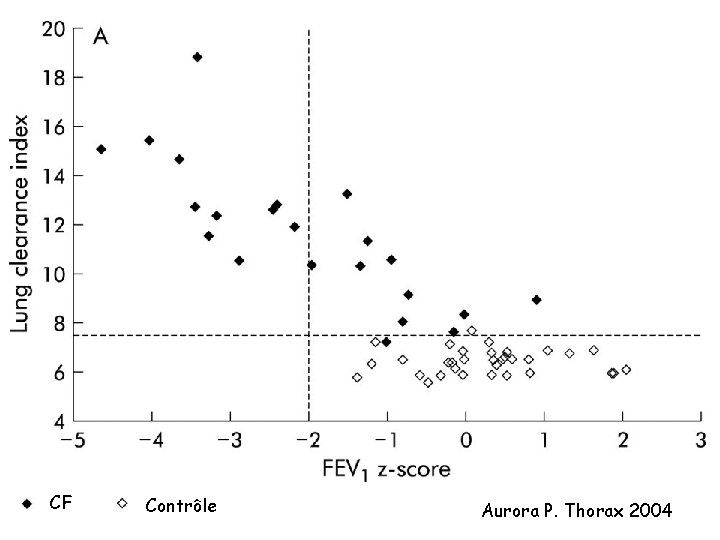 CF Contrôle Aurora P. Thorax 2004 