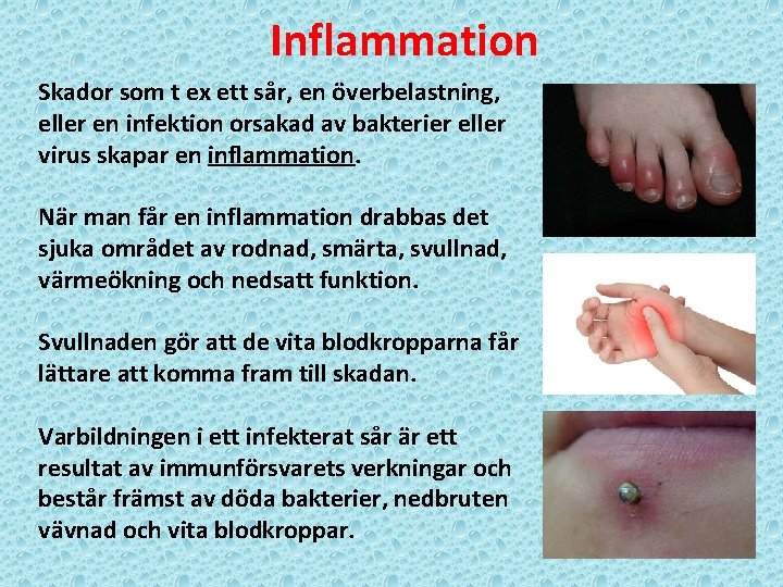 Inflammation Skador som t ex ett sår, en överbelastning, eller en infektion orsakad av