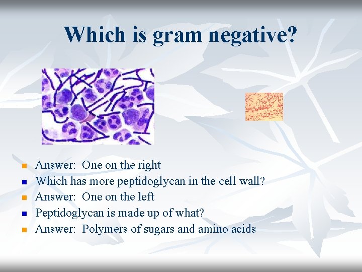 Which is gram negative? n n n Answer: One on the right Which has