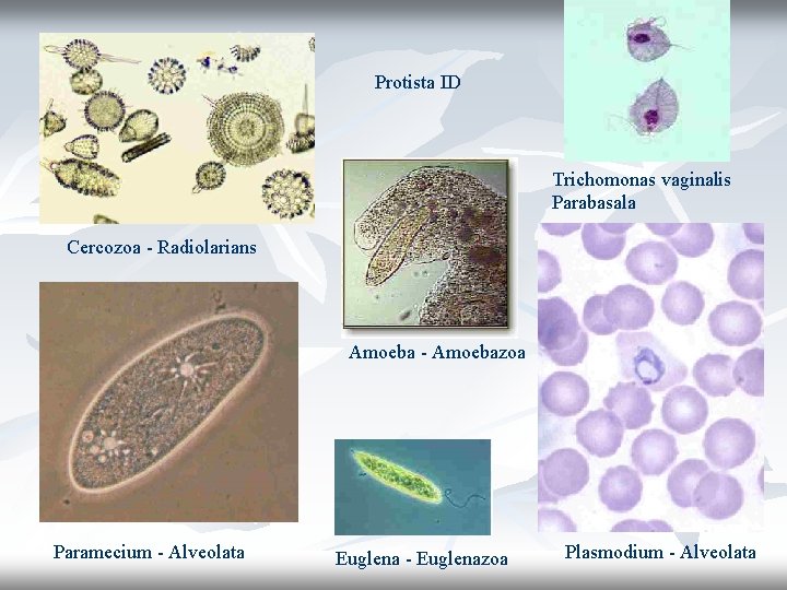 Protista ID Trichomonas vaginalis Parabasala Cercozoa - Radiolarians Amoeba - Amoebazoa Paramecium - Alveolata