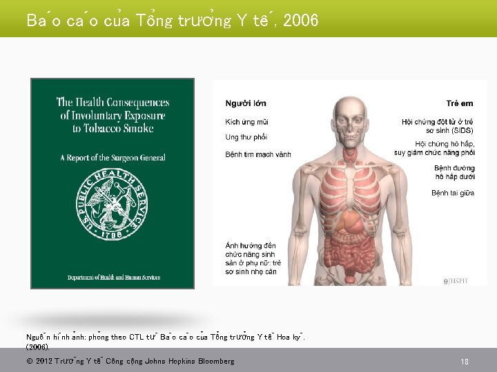 Ba o cu a Tô ng trươ ng Y tê , 2006 Nguô n