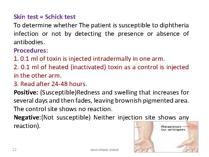 Skin test = Schick test To determine whether The patient is susceptible to diphtheria