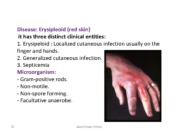 Disease: Erysipleoid (red skin) it has three distinct clinical entities: 1. Erysipeloid : Localized
