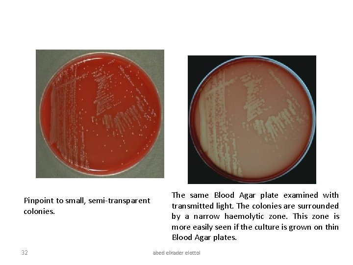 Pinpoint to small, semi-transparent colonies. 32 The same Blood Agar plate examined with transmitted