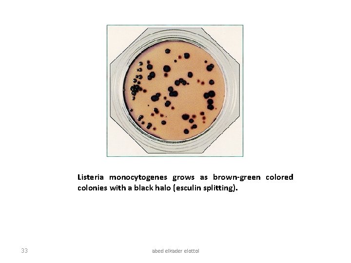 Listeria monocytogenes grows as brown-green colored colonies with a black halo (esculin splitting). 33