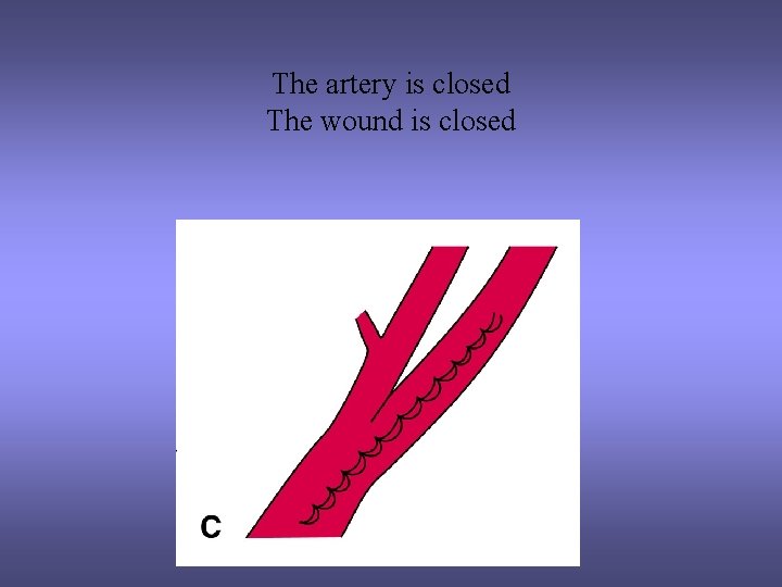 The artery is closed The wound is closed 