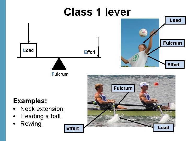 Class 1 lever Load Fulcrum Load Effort Fulcrum Examples: • Neck extension. • Heading
