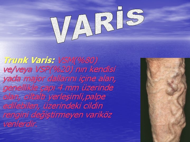 Trunk Varis: VSM(%80) ve/veya VSP(%20) nın kendisi yada major dallarını içine alan, genellikle çapı