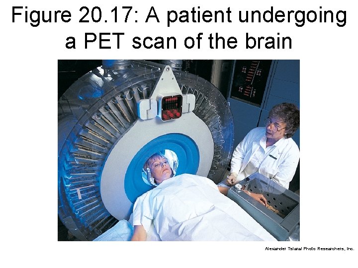 Figure 20. 17: A patient undergoing a PET scan of the brain Alexander Tsiara/
