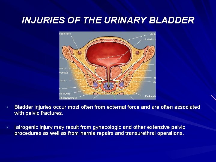 INJURIES OF THE URINARY BLADDER • Bladder injuries occur most often from external force