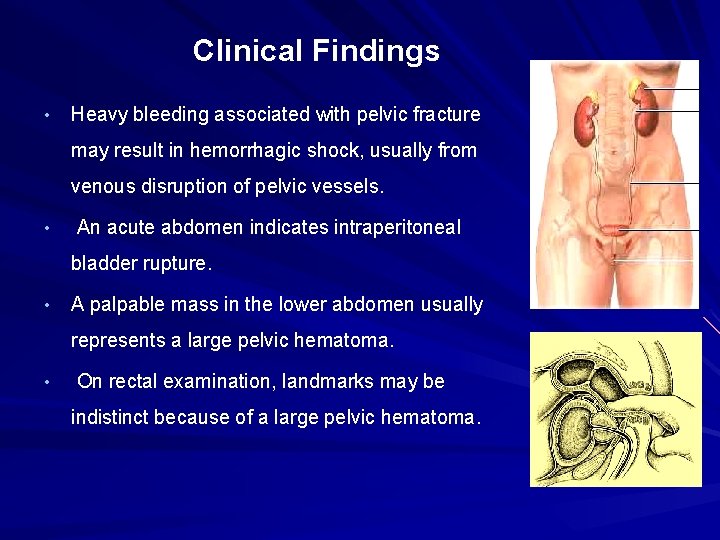 Clinical Findings • Heavy bleeding associated with pelvic fracture may result in hemorrhagic shock,