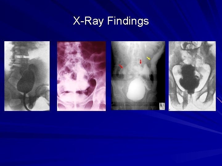 X-Ray Findings 