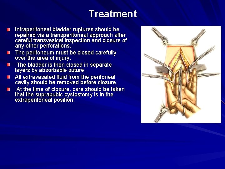 Treatment Intraperitoneal bladder ruptures should be repaired via a transperitoneal approach after careful transvesical