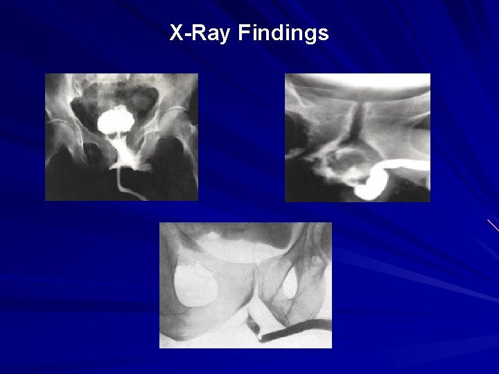 X-Ray Findings 