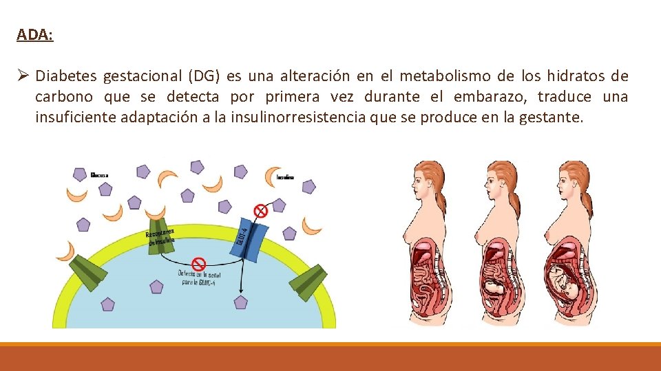 ADA: Ø Diabetes gestacional (DG) es una alteración en el metabolismo de los hidratos