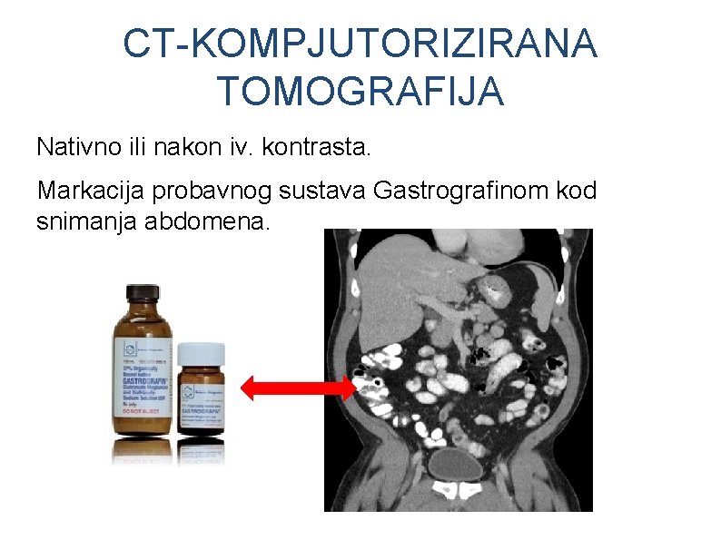 CT-KOMPJUTORIZIRANA TOMOGRAFIJA Nativno ili nakon iv. kontrasta. Markacija probavnog sustava Gastrografinom kod snimanja abdomena. CT-KOMPJUTORIZIRANA TOMOGRAFIJA Nativno ili nakon iv. kontrasta. Markacija probavnog sustava Gastrografinom kod snimanja abdomena.