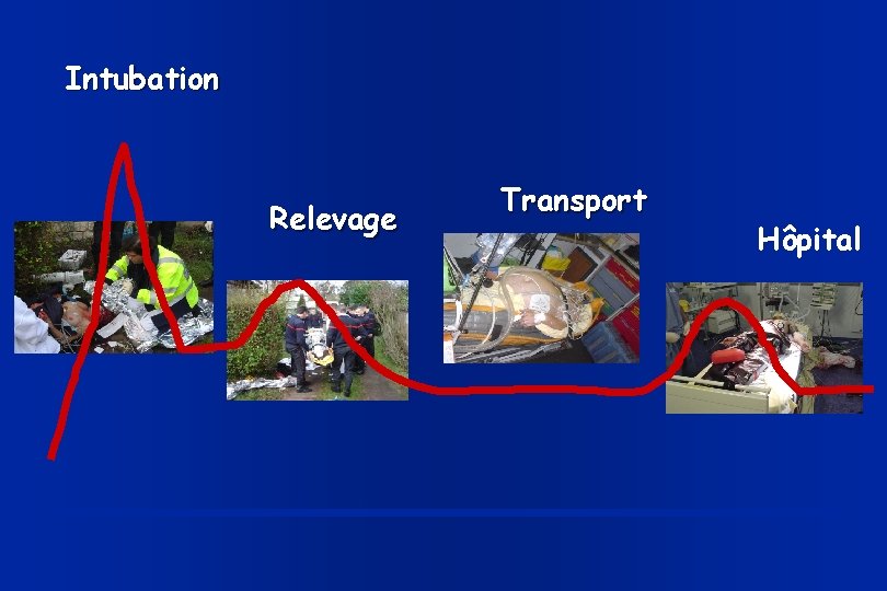 Intubation Relevage Transport Hôpital 