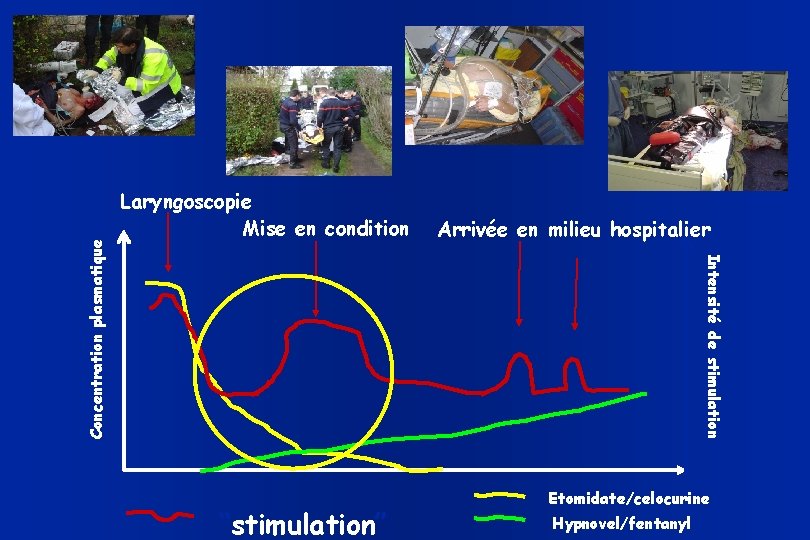 Arrivée en milieu hospitalier Intensité de stimulation Concentration plasmatique Laryngoscopie Mise en condition “stimulation”
