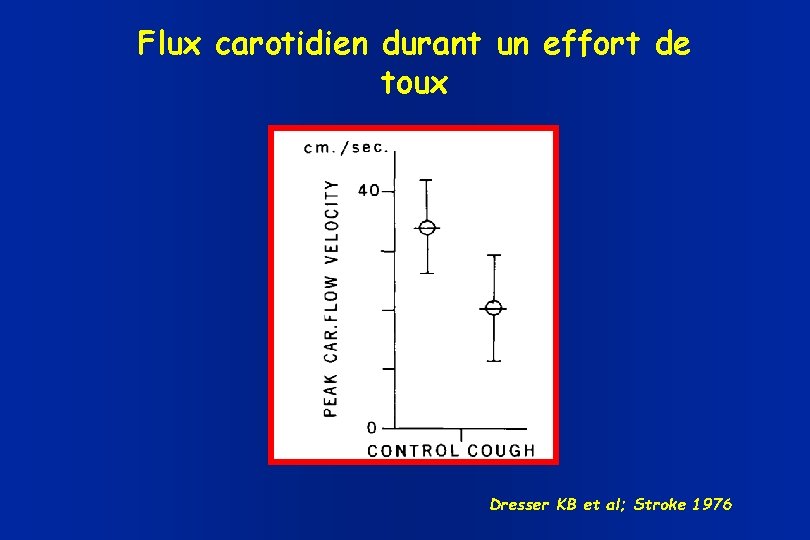 Flux carotidien durant un effort de toux Dresser KB et al; Stroke 1976 