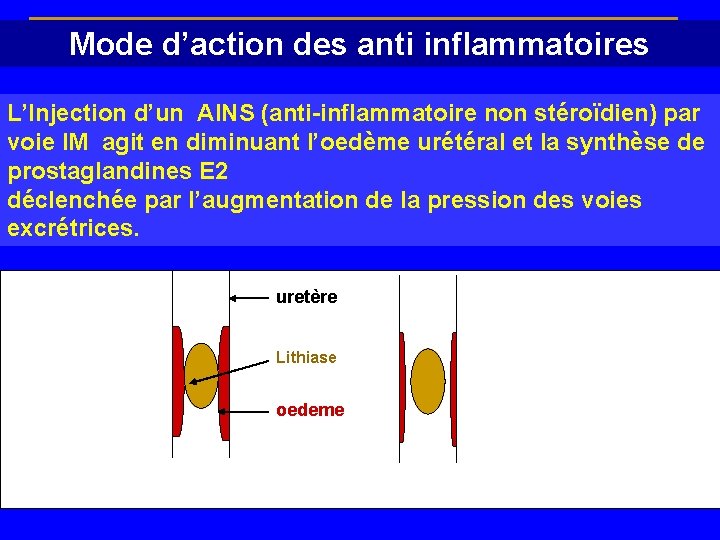 Mode d’action des anti inflammatoires L’Injection d’un AINS (anti-inflammatoire non stéroïdien) par voie IM