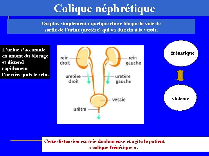Colique néphrétique Ou plus simplement : quelque chose bloque la voie de sortie de