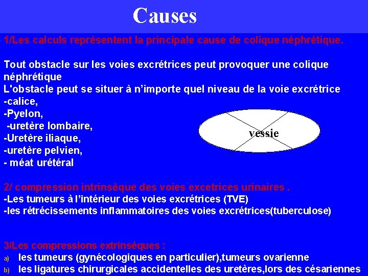 Causes 1/Les calculs représentent la principale cause de colique néphrétique. Tout obstacle sur les