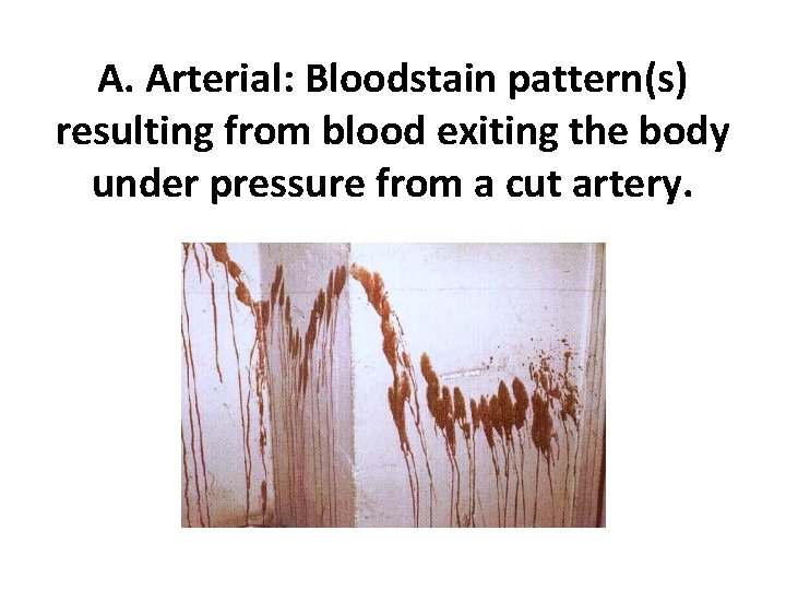 A. Arterial: Bloodstain pattern(s) resulting from blood exiting the body under pressure from a