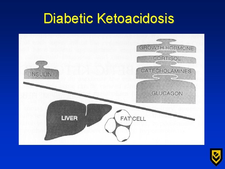 Diabetic Ketoacidosis 