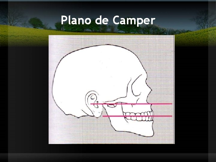 Plano de Camper 