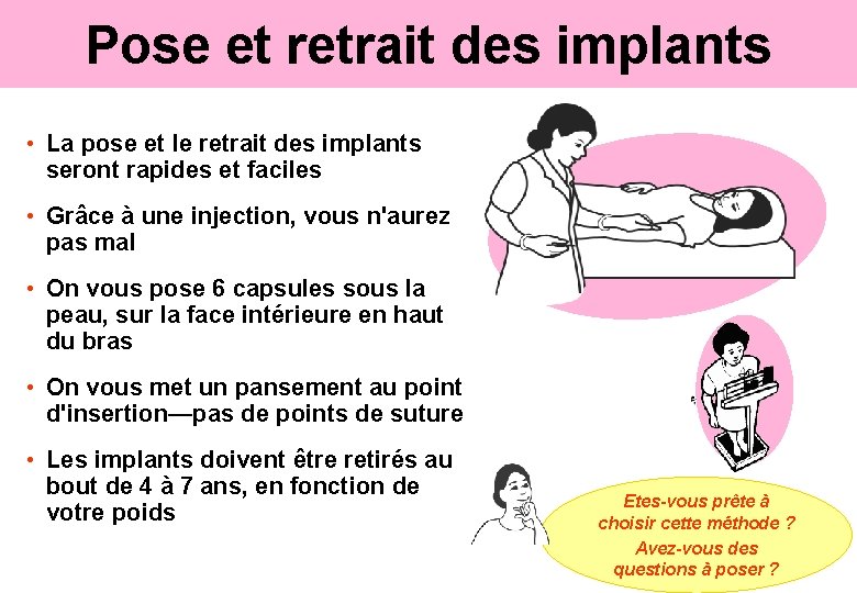 Pose et retrait des implants • La pose et le retrait des implants seront