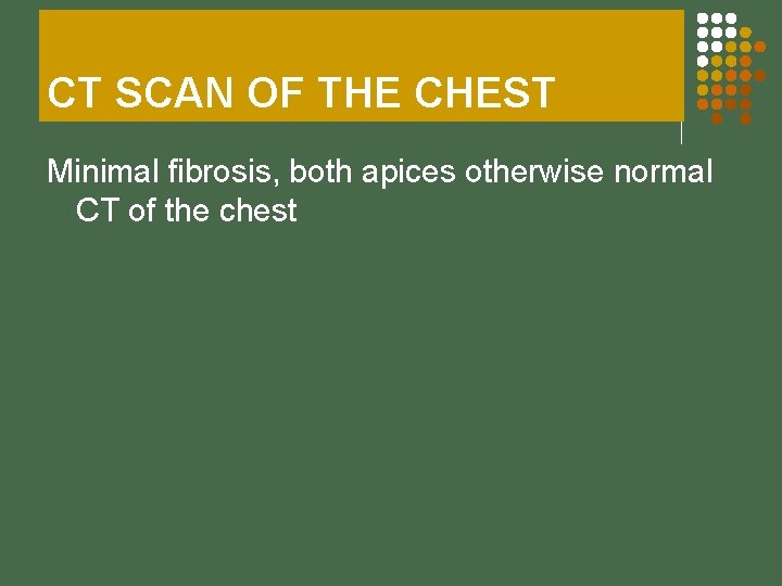 CT SCAN OF THE CHEST Minimal fibrosis, both apices otherwise normal CT of the