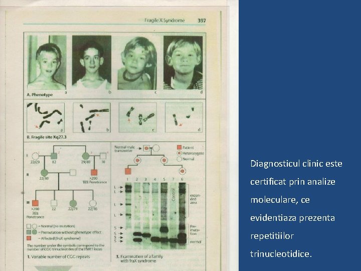 Diagnosticul clinic este certificat prin analize moleculare, ce evidentiaza prezenta repetitiilor trinucleotidice. 