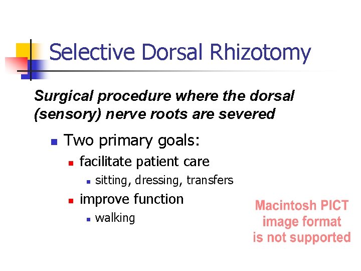 Selective Dorsal Rhizotomy Surgical procedure where the dorsal (sensory) nerve roots are severed n