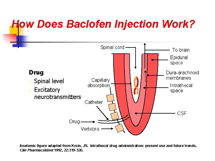 How Does Baclofen Injection Work? Spinal cord To brain Epidural space Drug • Spinal