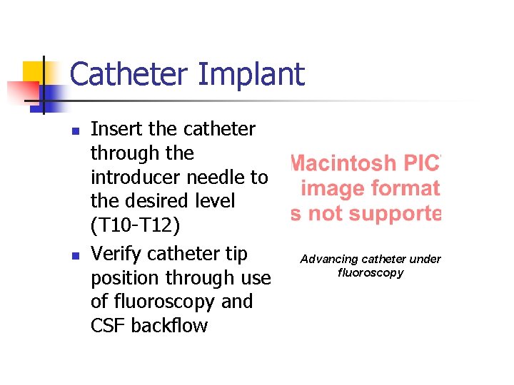 Catheter Implant n n Insert the catheter through the introducer needle to the desired
