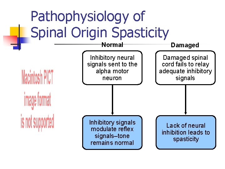 Pathophysiology of Spinal Origin Spasticity Normal Damaged Inhibitory neural signals sent to the alpha