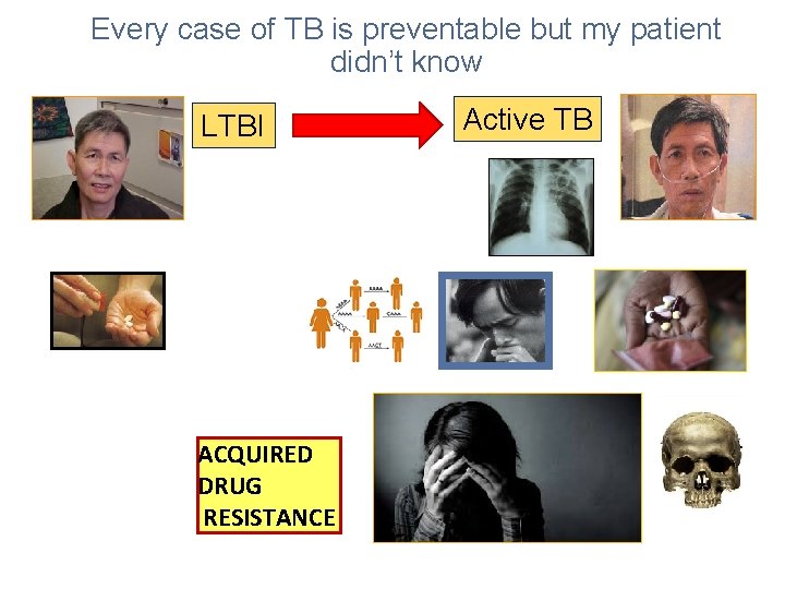 Every case of TB is preventable but my patient didn’t know LTBI ACQUIRED DRUG